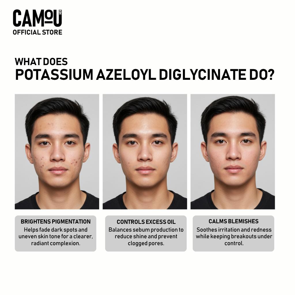 Camou Acne Pro Bar Soap