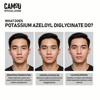 Camou Acne Pro Bar Soap