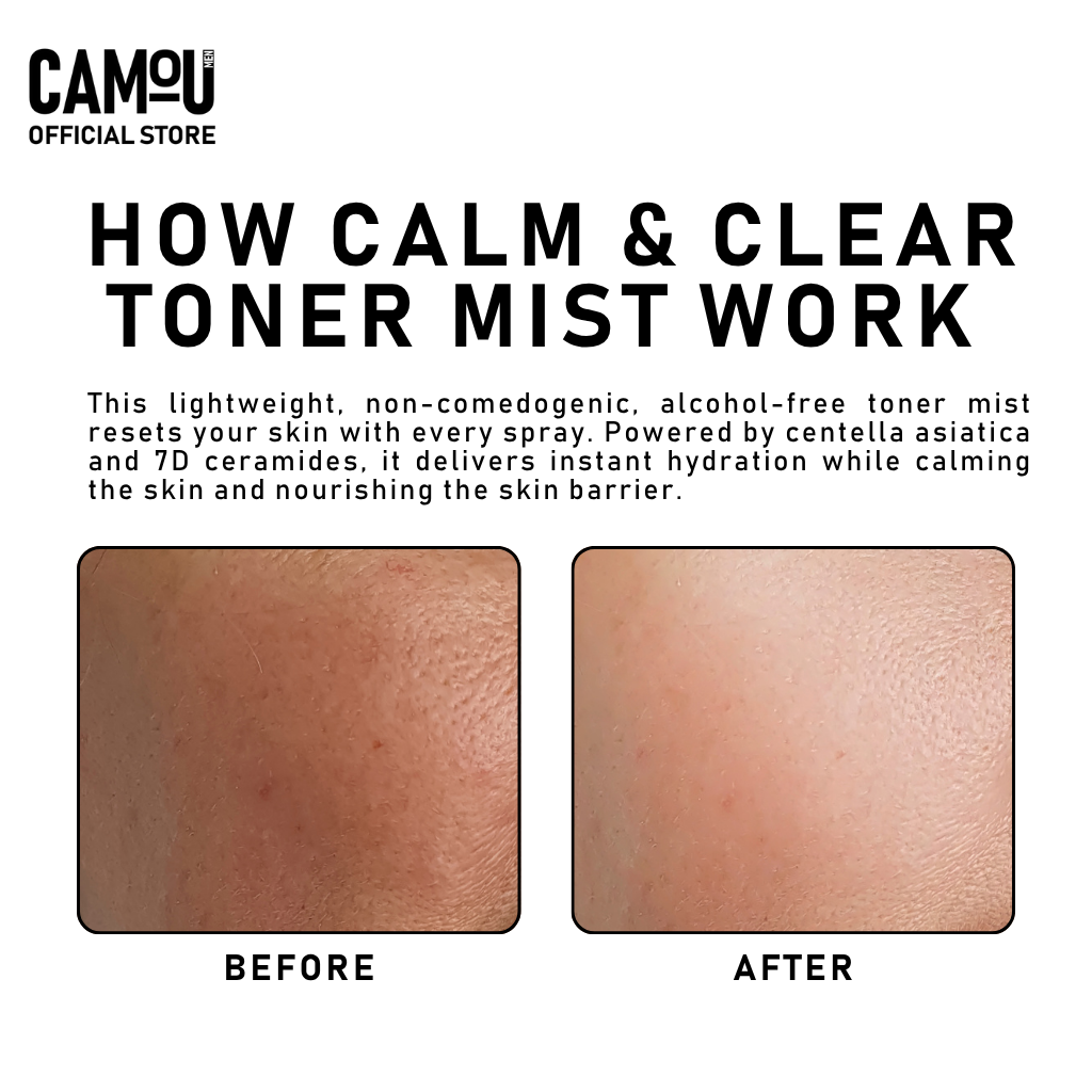 Camou Calm & Clear Toner Mist 100mL