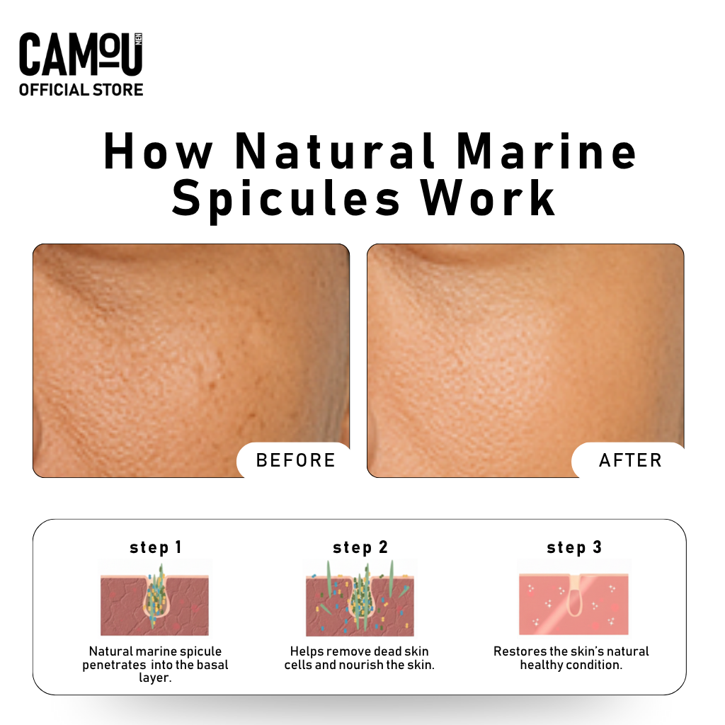 Camou Microneedle Serum (Level 1)